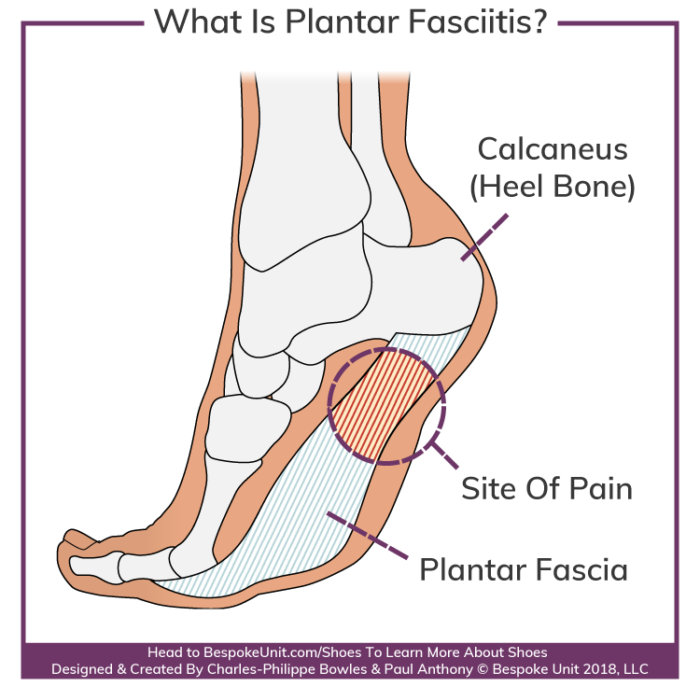 Plantar Fasciitis Shoes Top 10 Best Shoes For Plantar Fasciitis In 2018